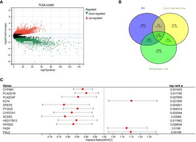 HPGDS is a novel prognostic marker associated with lipid metabolism and aggressiveness in lung adenocarcinoma